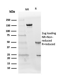 Follistatin/Activin Binding Protein Antibody in SDS-PAGE (SDS-PAGE)