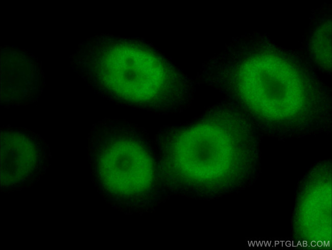 RAN Antibody in Immunocytochemistry (ICC/IF)