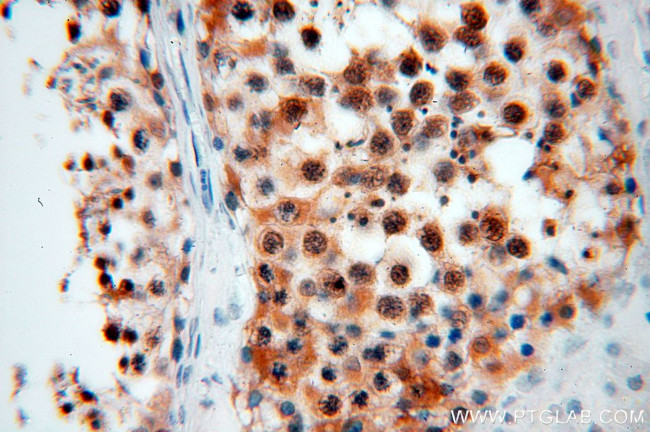 RAN Antibody in Immunohistochemistry (Paraffin) (IHC (P))