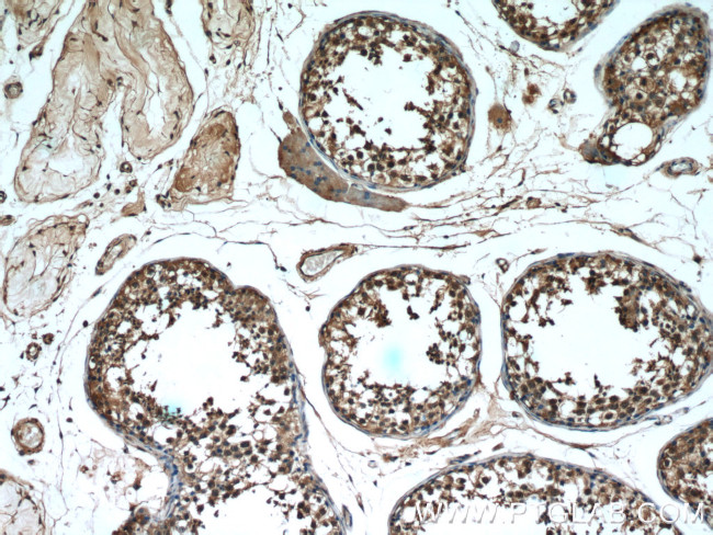 RAN Antibody in Immunohistochemistry (Paraffin) (IHC (P))