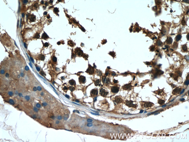 RAN Antibody in Immunohistochemistry (Paraffin) (IHC (P))