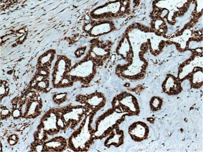 RAN Antibody in Immunohistochemistry (Paraffin) (IHC (P))