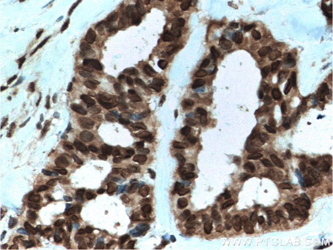 RAN Antibody in Immunohistochemistry (Paraffin) (IHC (P))