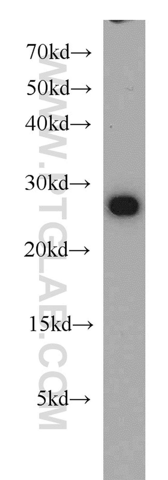 RAN Antibody in Western Blot (WB)