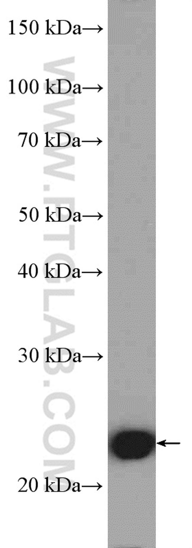 RAN Antibody in Western Blot (WB)