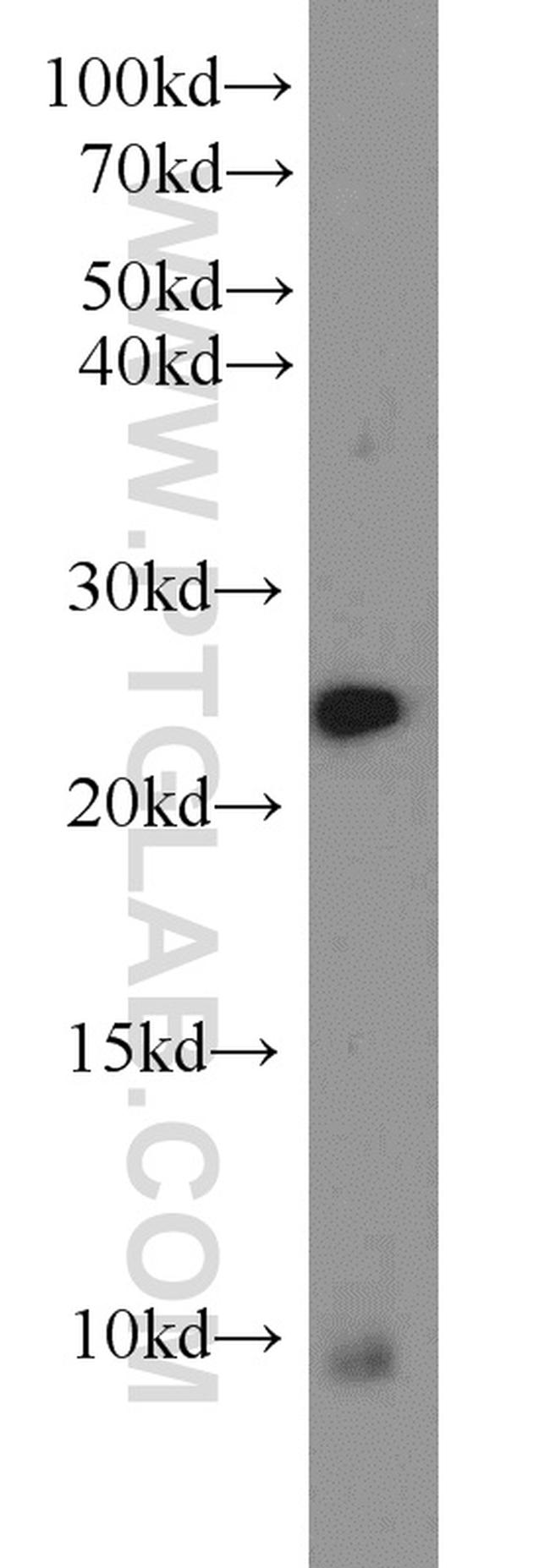 RAN Antibody in Western Blot (WB)