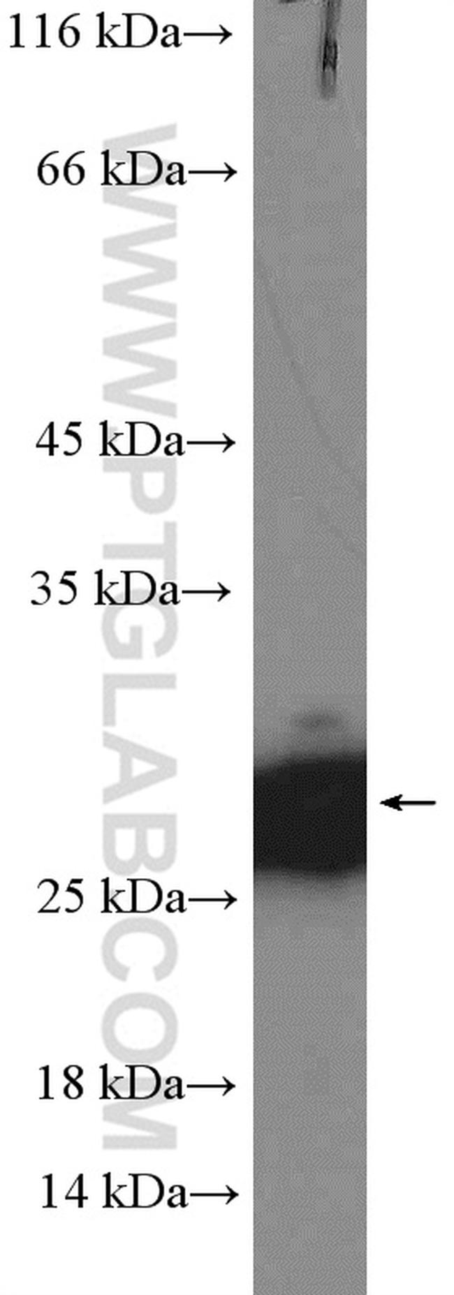 RAN Antibody in Western Blot (WB)