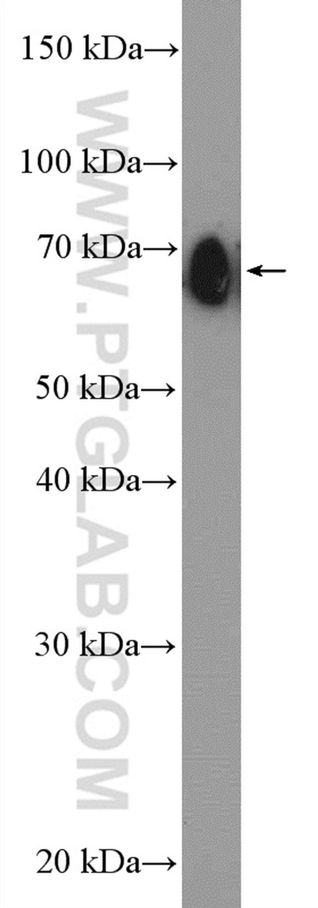 CLINT1 Antibody in Western Blot (WB)