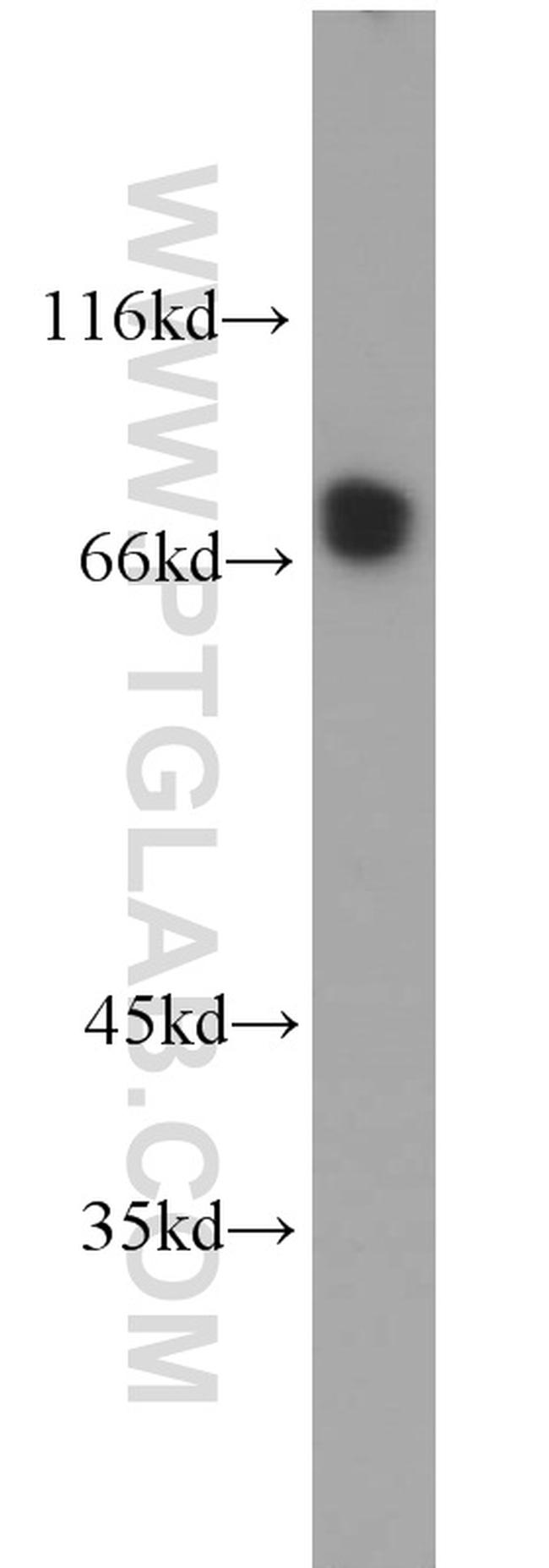 CLINT1 Antibody in Western Blot (WB)