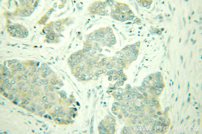 Seladin 1 Antibody in Immunohistochemistry (Paraffin) (IHC (P))