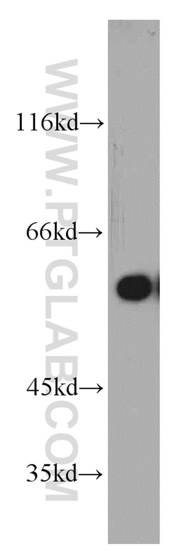 Seladin 1 Antibody in Western Blot (WB)