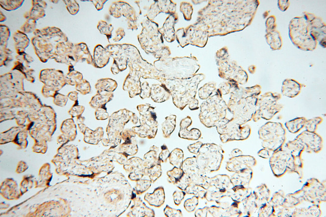 Seladin 1 Antibody in Immunohistochemistry (Paraffin) (IHC (P))