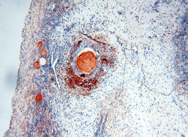 Seladin 1 Antibody in Immunohistochemistry (Paraffin) (IHC (P))