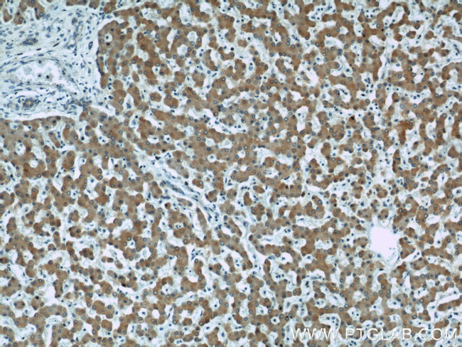 Seladin 1 Antibody in Immunohistochemistry (Paraffin) (IHC (P))