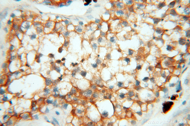 Seladin 1 Antibody in Immunohistochemistry (Paraffin) (IHC (P))