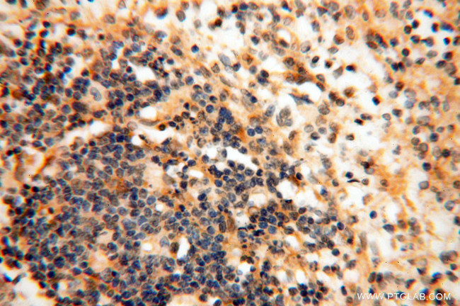 Seladin 1 Antibody in Immunohistochemistry (Paraffin) (IHC (P))