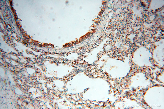 Seladin 1 Antibody in Immunohistochemistry (Paraffin) (IHC (P))