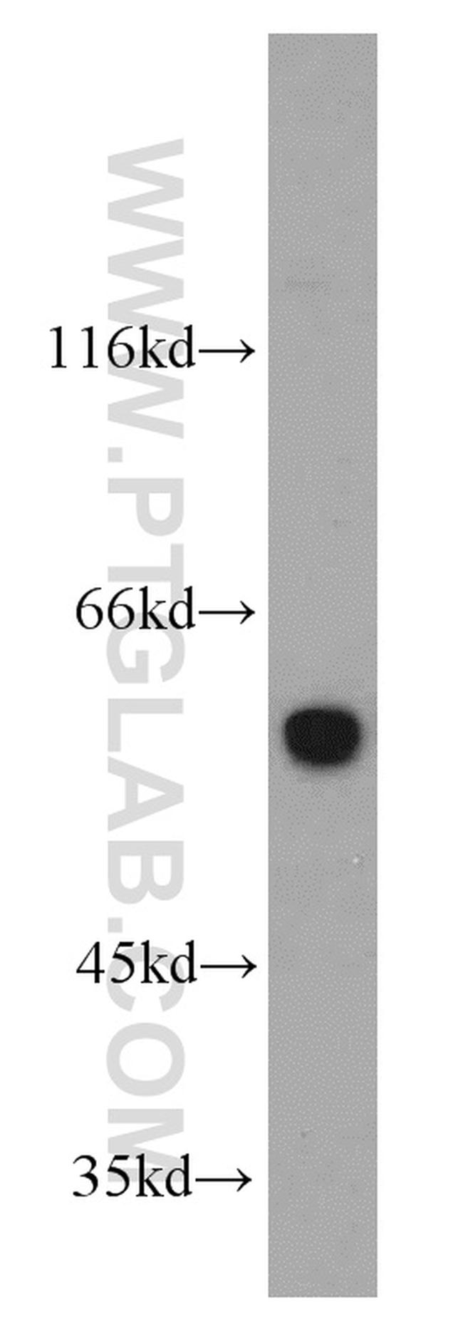 Seladin 1 Antibody in Western Blot (WB)