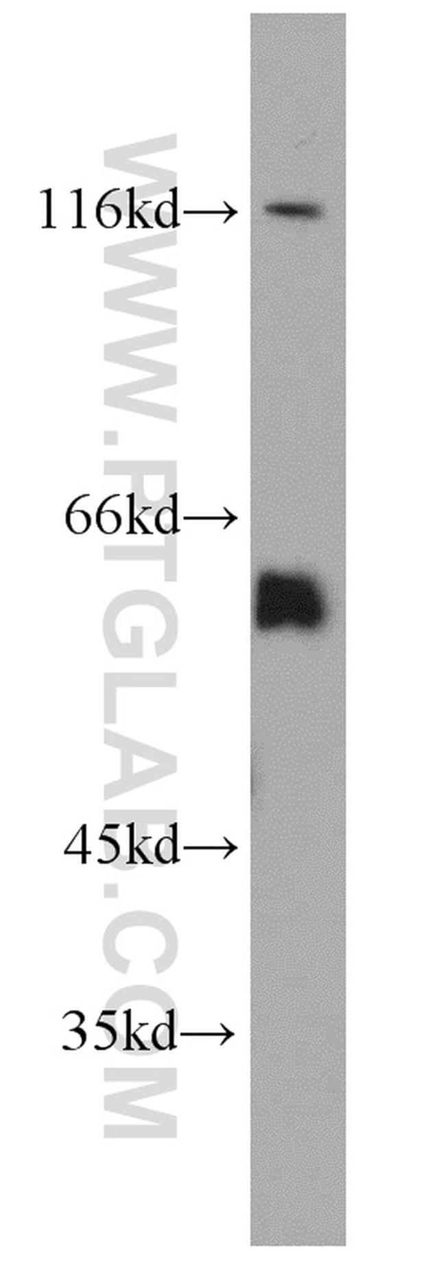 Seladin 1 Antibody in Western Blot (WB)