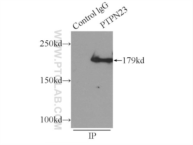 PTPN23 Antibody in Immunoprecipitation (IP)