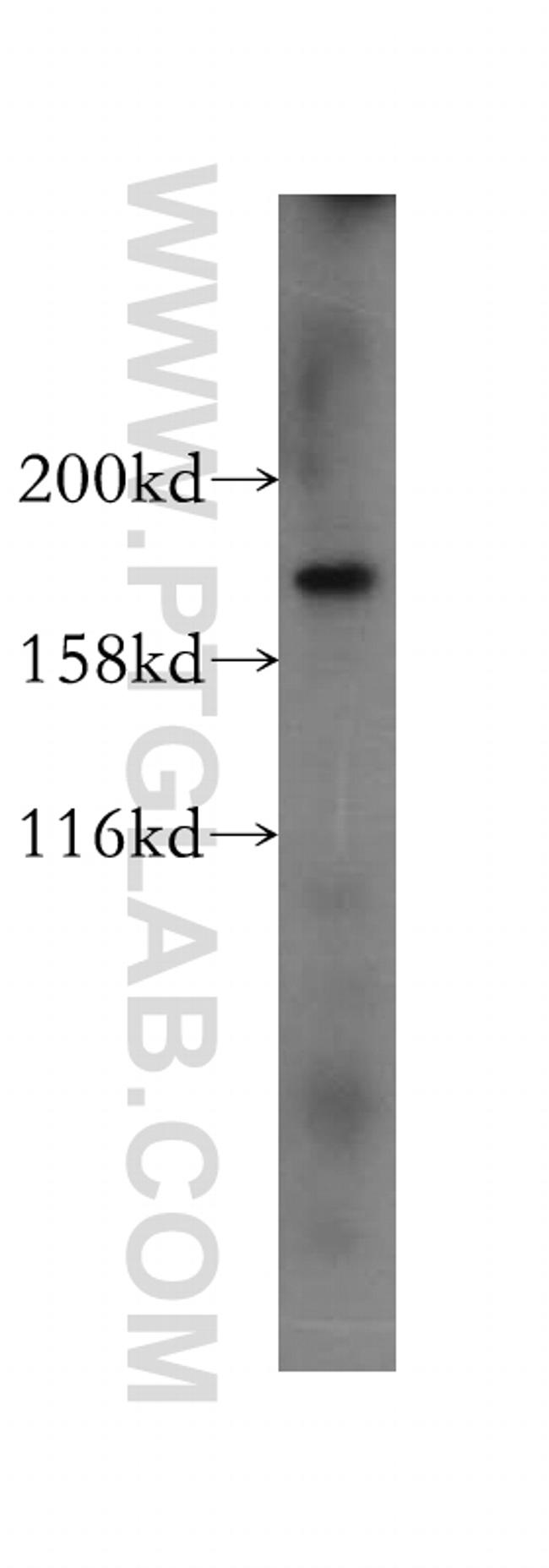 PTPN23 Antibody in Western Blot (WB)