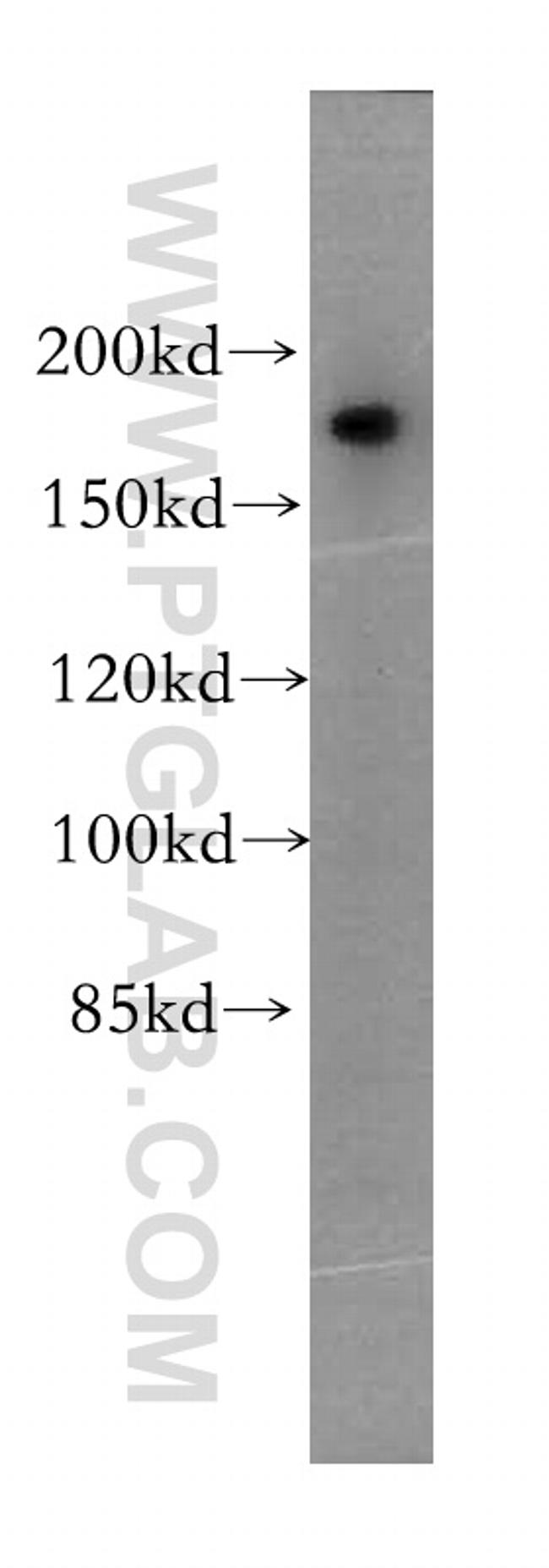 PTPN23 Antibody in Western Blot (WB)