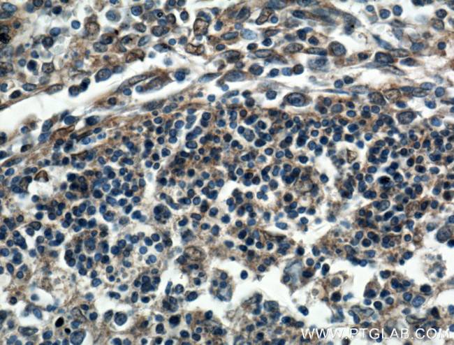 USP5 Antibody in Immunohistochemistry (Paraffin) (IHC (P))