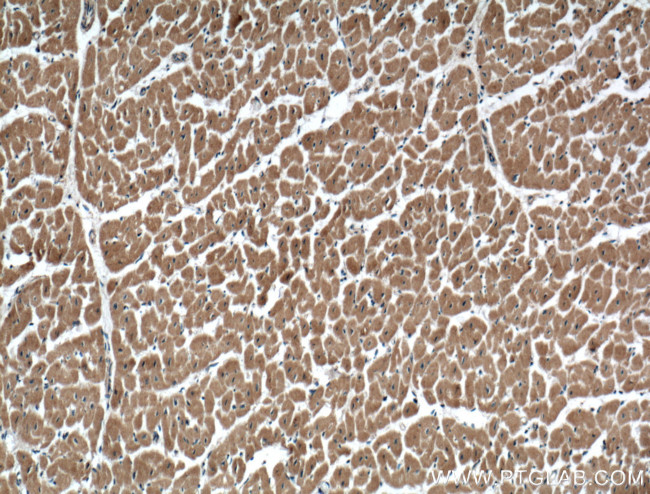 USP5 Antibody in Immunohistochemistry (Paraffin) (IHC (P))