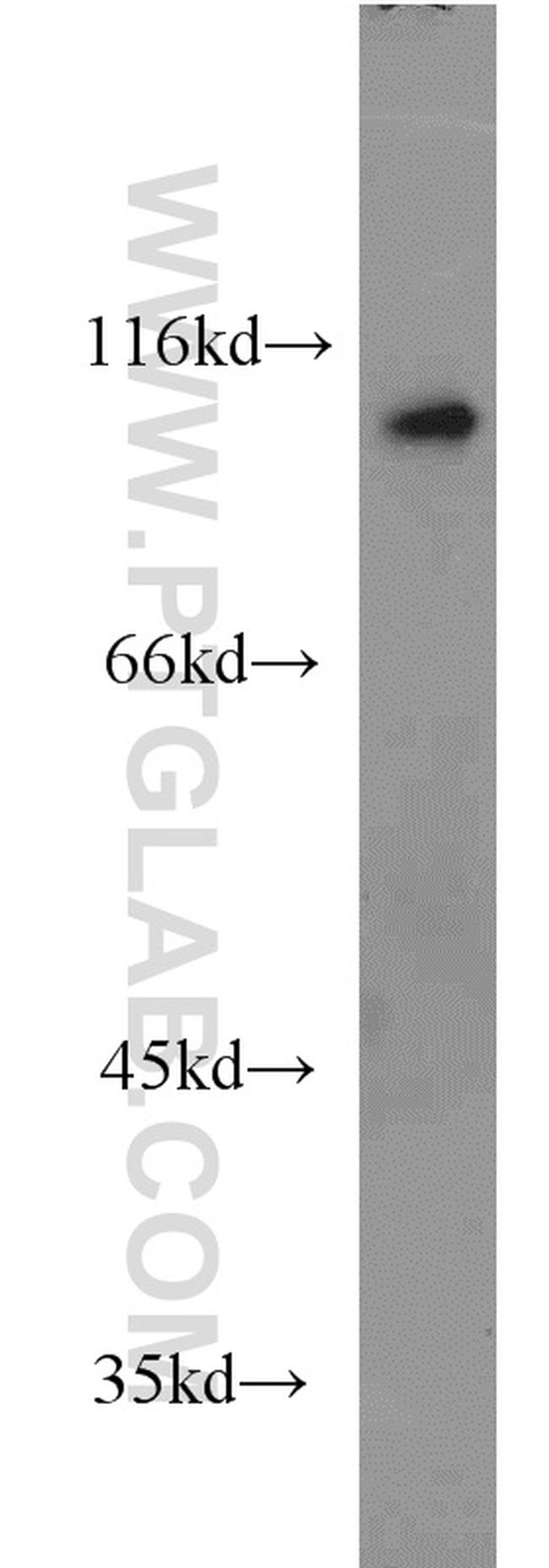 USP5 Antibody in Western Blot (WB)