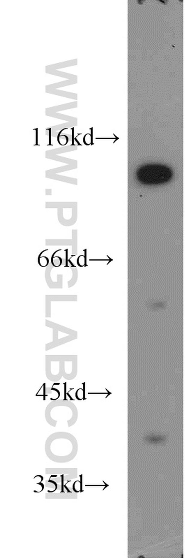 USP5 Antibody in Western Blot (WB)