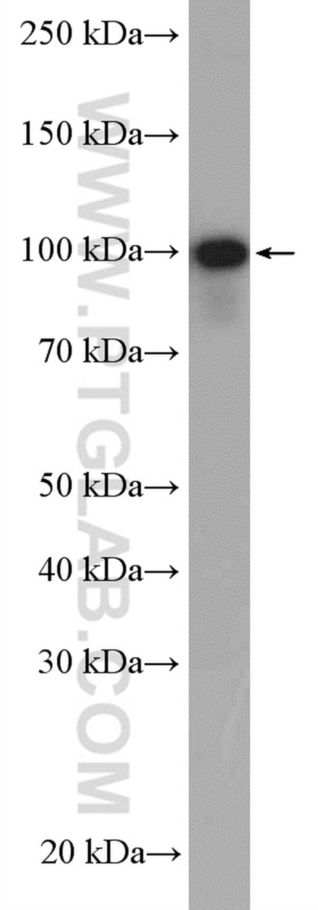 USP5 Antibody in Western Blot (WB)