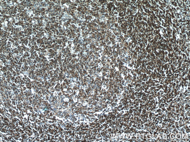 TCL1A Antibody in Immunohistochemistry (Paraffin) (IHC (P))