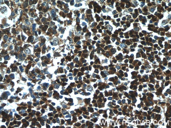 TCL1A Antibody in Immunohistochemistry (Paraffin) (IHC (P))