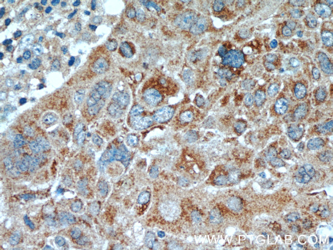 TCL1A Antibody in Immunohistochemistry (Paraffin) (IHC (P))