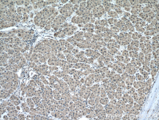 CHMP2A Antibody in Immunohistochemistry (Paraffin) (IHC (P))