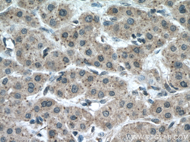 CHMP2A Antibody in Immunohistochemistry (Paraffin) (IHC (P))