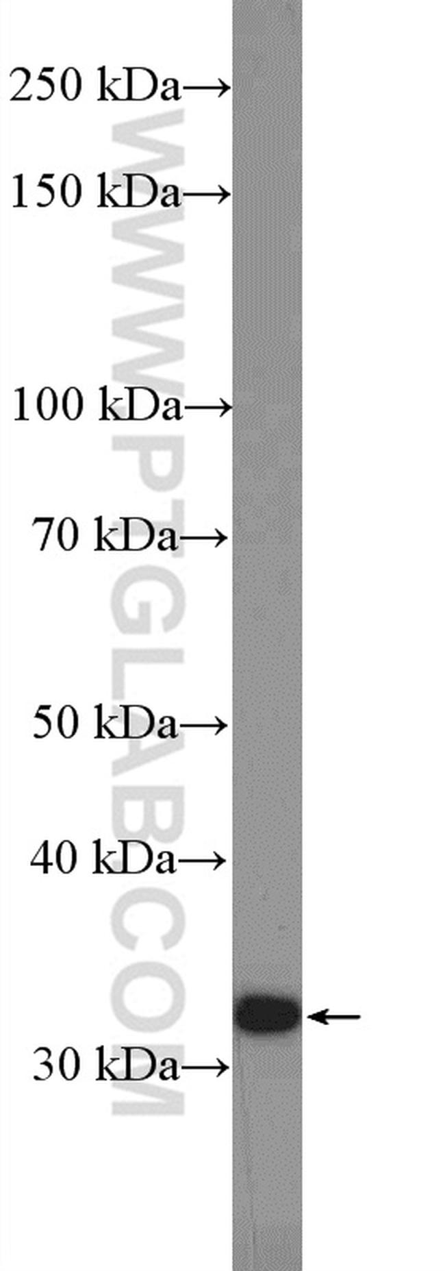 CHMP2A Antibody in Western Blot (WB)