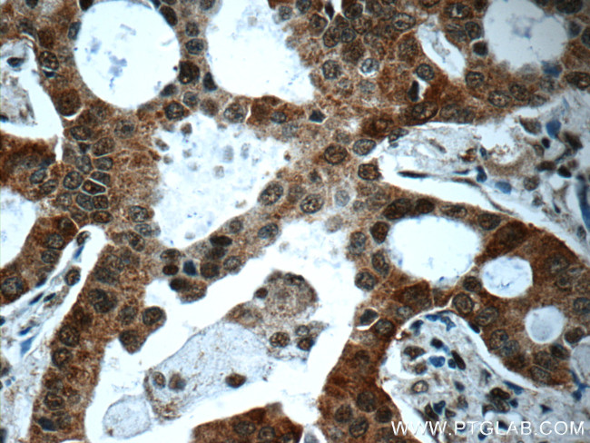 IRAK1 Antibody in Immunohistochemistry (Paraffin) (IHC (P))