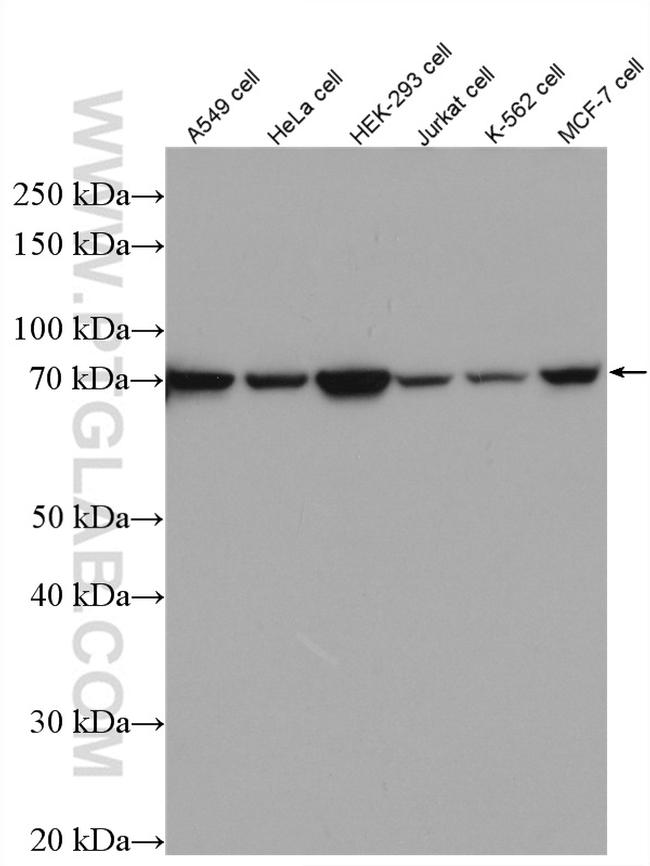 IRAK1 Antibody in Western Blot (WB)