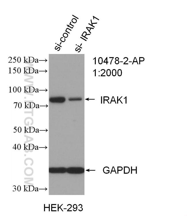 IRAK1 Antibody in Western Blot (WB)