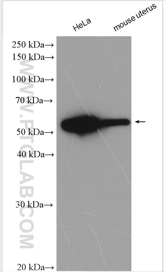 Annexin A11 Antibody in Western Blot (WB)