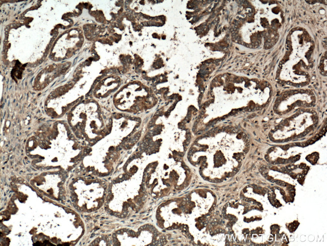 Annexin A11 Antibody in Immunohistochemistry (Paraffin) (IHC (P))