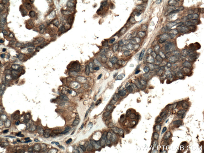 Annexin A11 Antibody in Immunohistochemistry (Paraffin) (IHC (P))