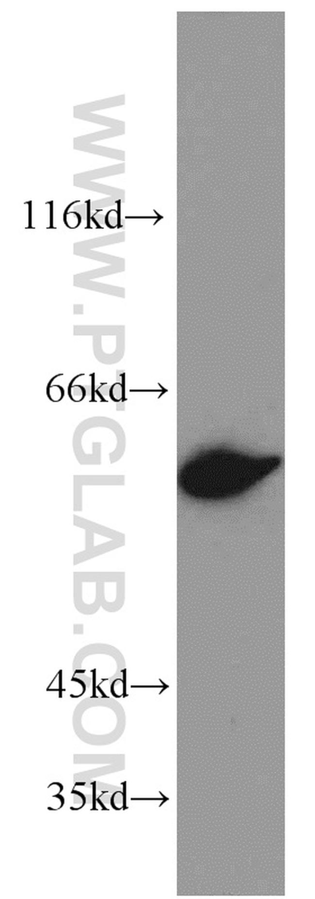 Annexin A11 Antibody in Western Blot (WB)