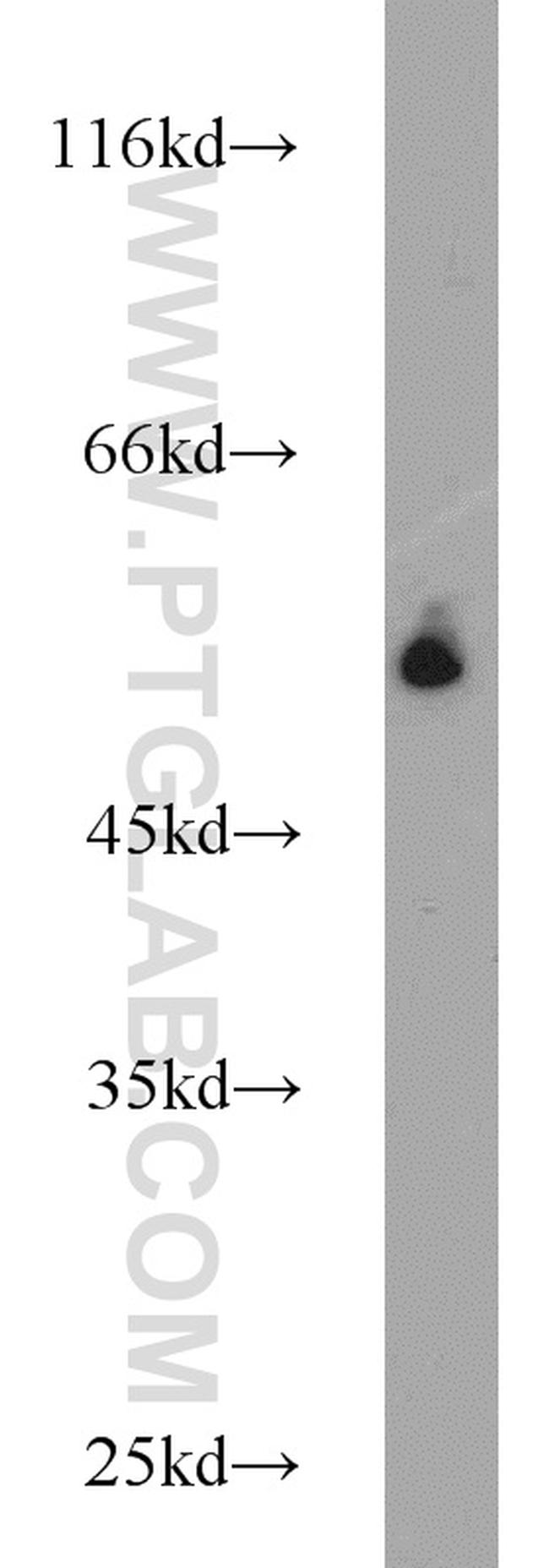 Annexin A11 Antibody in Western Blot (WB)