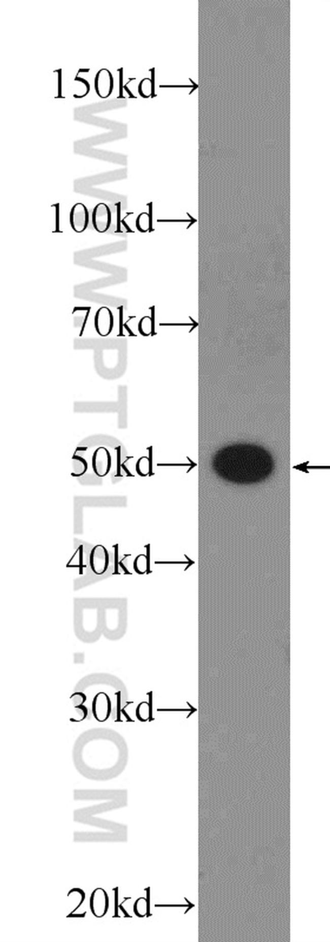 Annexin A11 Antibody in Western Blot (WB)