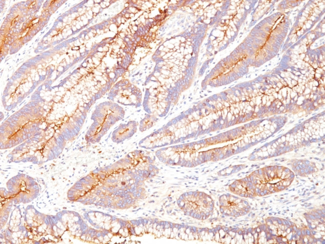 Carcinoembryonic Antigen (CEA)/CD66 Antibody in Immunohistochemistry (Paraffin) (IHC (P))