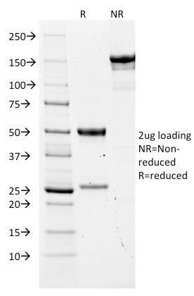 Carcinoembryonic Antigen (CEA)/CD66 Antibody in SDS-PAGE (SDS-PAGE)