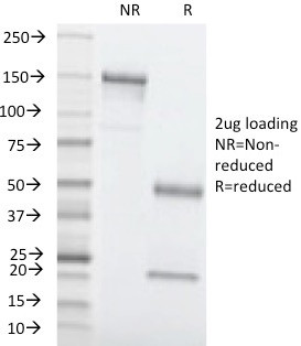 Carcinoembryonic Antigen (CEA)/CD66 Antibody in SDS-PAGE (SDS-PAGE)