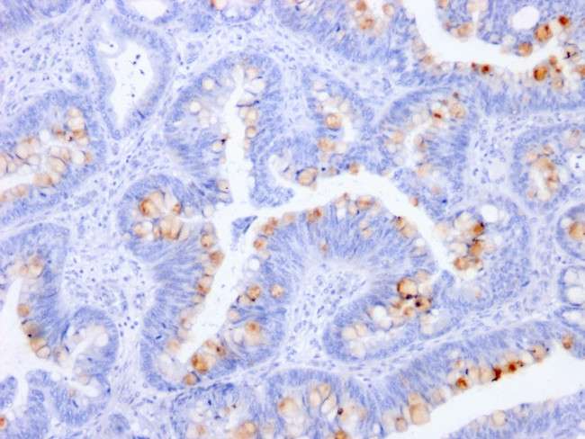 Carcinoembryonic Antigen (CEA)/CD66 Antibody in Immunohistochemistry (Paraffin) (IHC (P))